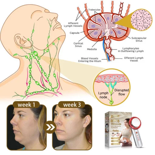 Furzero™ EMS Ultrasonic Far Infrared Anti-Cellulite Massager - Image 19