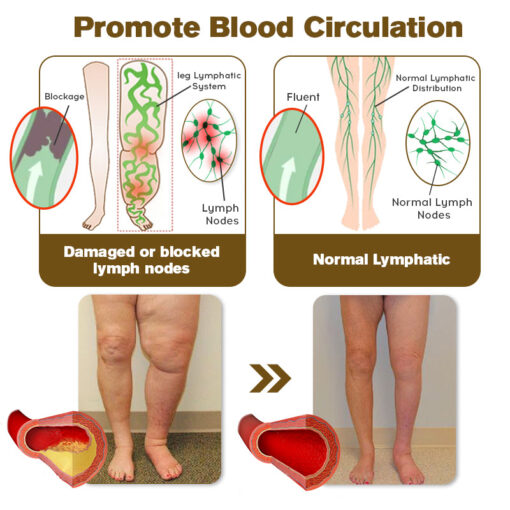 Furzero™ EMS Ultrasonic Far Infrared Anti-Cellulite Massager - Image 18