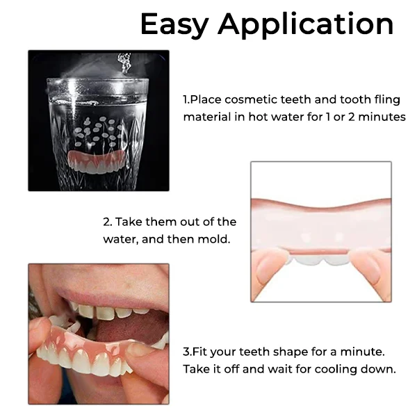 Oveallgo™ Comfort Soft Denture Reline Kit - Image 3