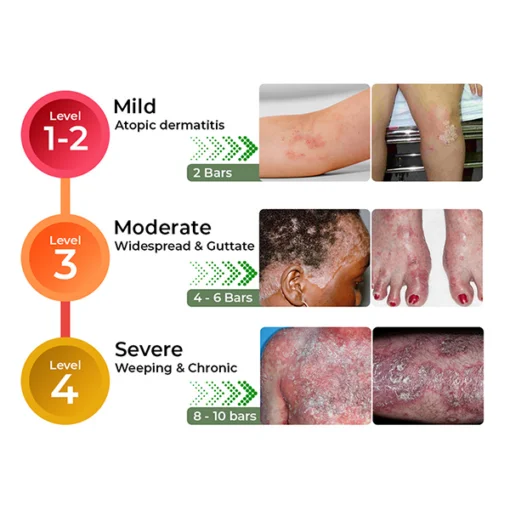 GFOUK™ Crócil Crocodile Oil Repair Aleppo Soap - Image 7