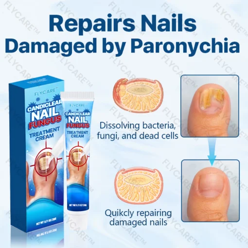 FLYCARE™ Candiclear Nail Fungus Treatment Cream - Image 7