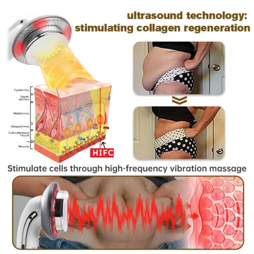 Furzero™ EMS Ultrasonic Far Infrared Anti-Cellulite Massager - Image 16