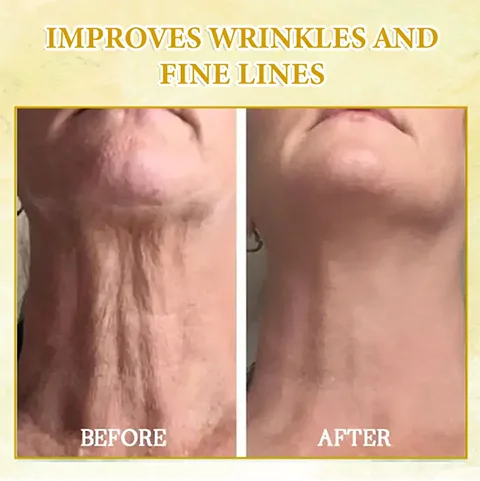 Oveallgo™ SkinFirming Rejuvenating Oil - Image 8
