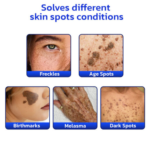 Furzero™ NonSpot Bee Venom Pigment Correction Cream - Image 6