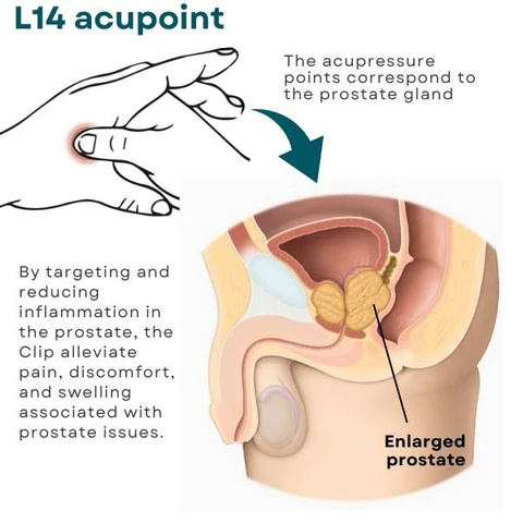 AEXZR™ Prostate Care Point Clip - Image 8