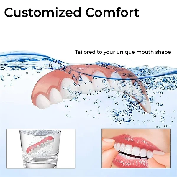 Oveallgo™ Comfort Soft Denture Reline Kit - Image 6