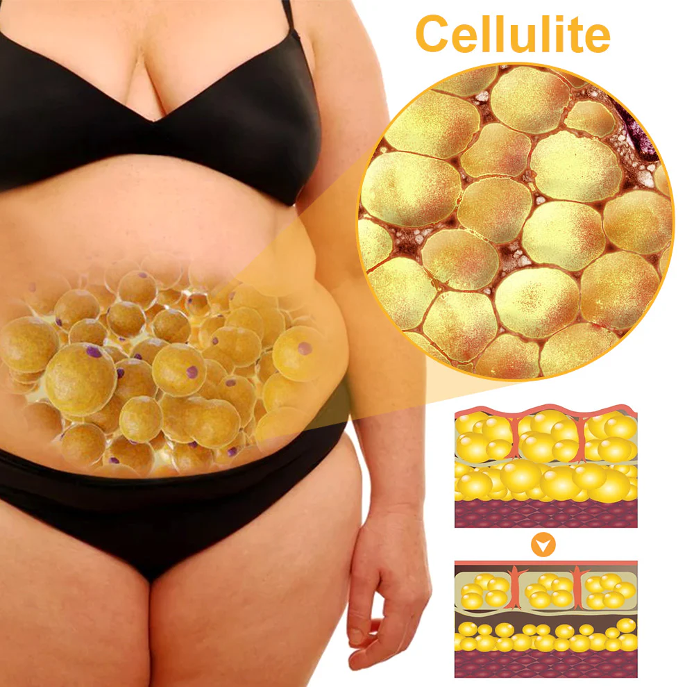 GFOUK™ BeeFuse VenomBelly Patch - Image 20