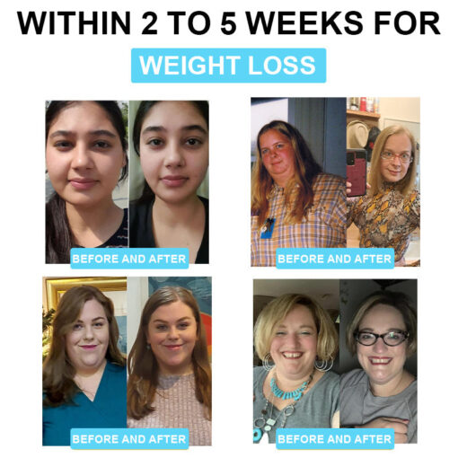 YAGOO™ Nano-Ion Fat-Burning Icy Silk Shapewear - Image 9