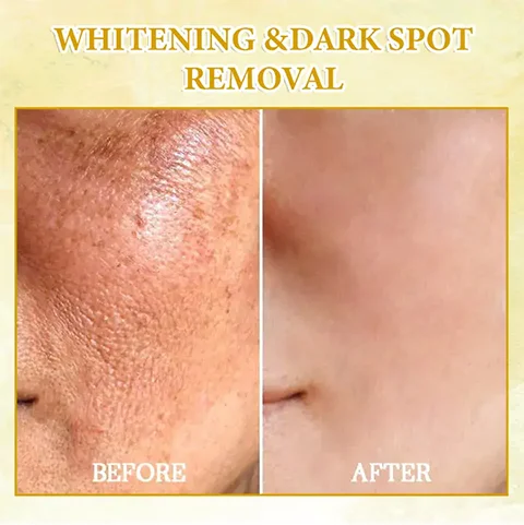 Oveallgo™ SkinFirming Rejuvenating Oil - Image 7