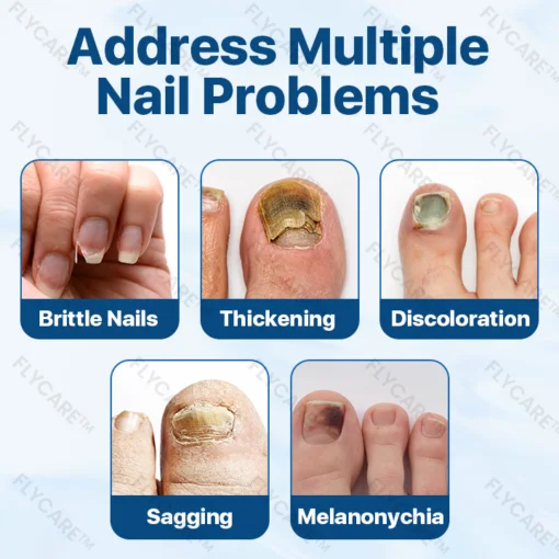 FLYCARE™ Candiclear Nail Fungus Treatment Cream - Image 5