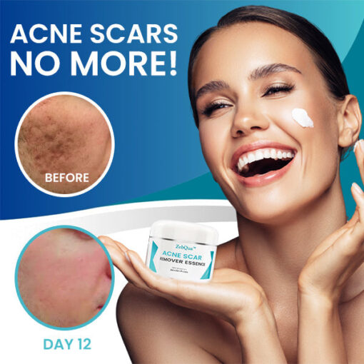 ZebQua™ Acne Scar Remover Essence - Image 3