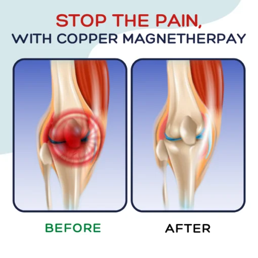 AEXZR™ Pure Copper MagneTherapy Bracelet - Image 6