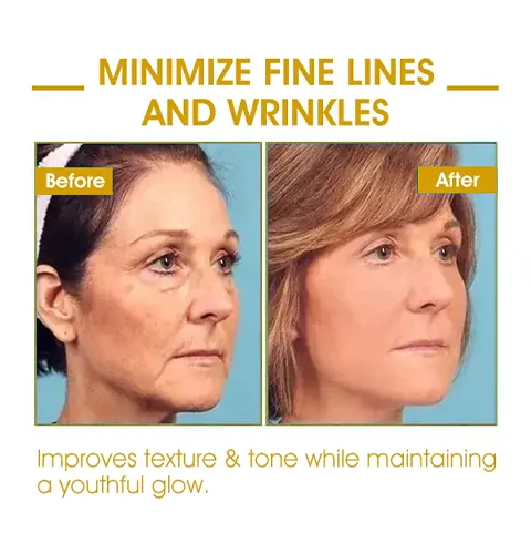 Oveallgo™ SkinFirming Rejuvenating Oil - Image 5