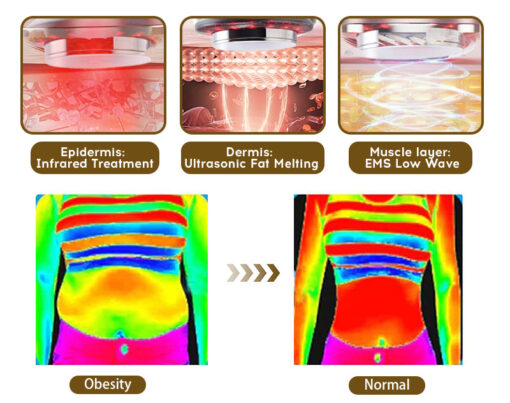 Furzero™ EMS Ultrasonic Far Infrared Anti-Cellulite Massager - Image 6