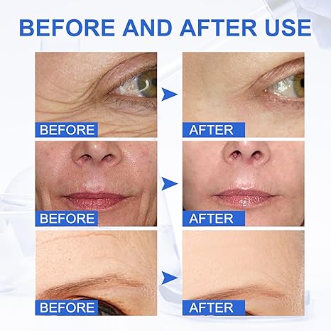 Tiworld™ Wrinkle Removal Face Cream - Image 8