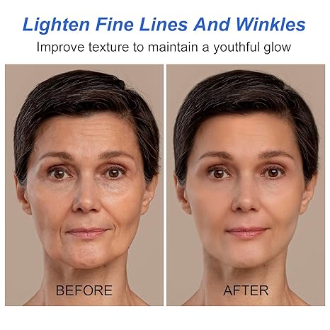 Tiworld™ Wrinkle Removal Face Cream - Image 7
