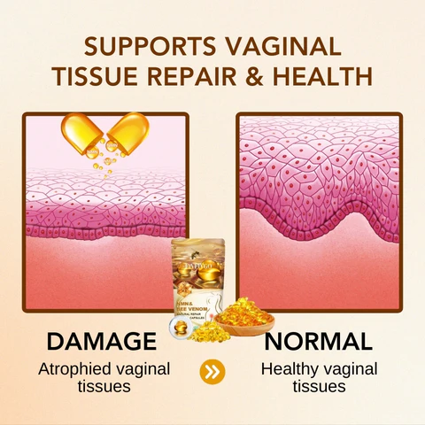 Oveallgo™ Bee Venom NMN Natural Repair Vaginal Capsules - Image 6