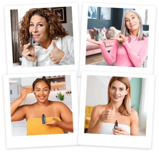 SpotErase 16 Natural Ingredients Dark Spots Remover - Image 4