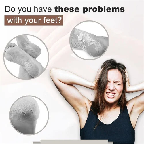 Biancat™ Cracked Skin Repair Cream - Image 5