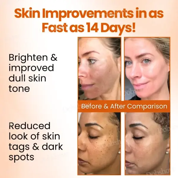 Dobshow™ SpotErase Trio Vitamin C 20% Removal Cream - Image 2