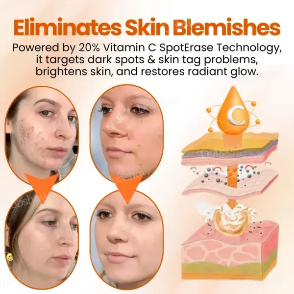 Dobshow™ SpotErase Trio Vitamin C 20% Removal Cream - Image 6