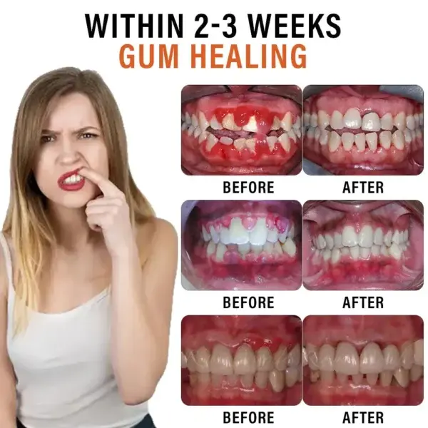 Ourlyard™ Bee Venom Antibacterial & Anti-Wart Oral Spray - Image 4