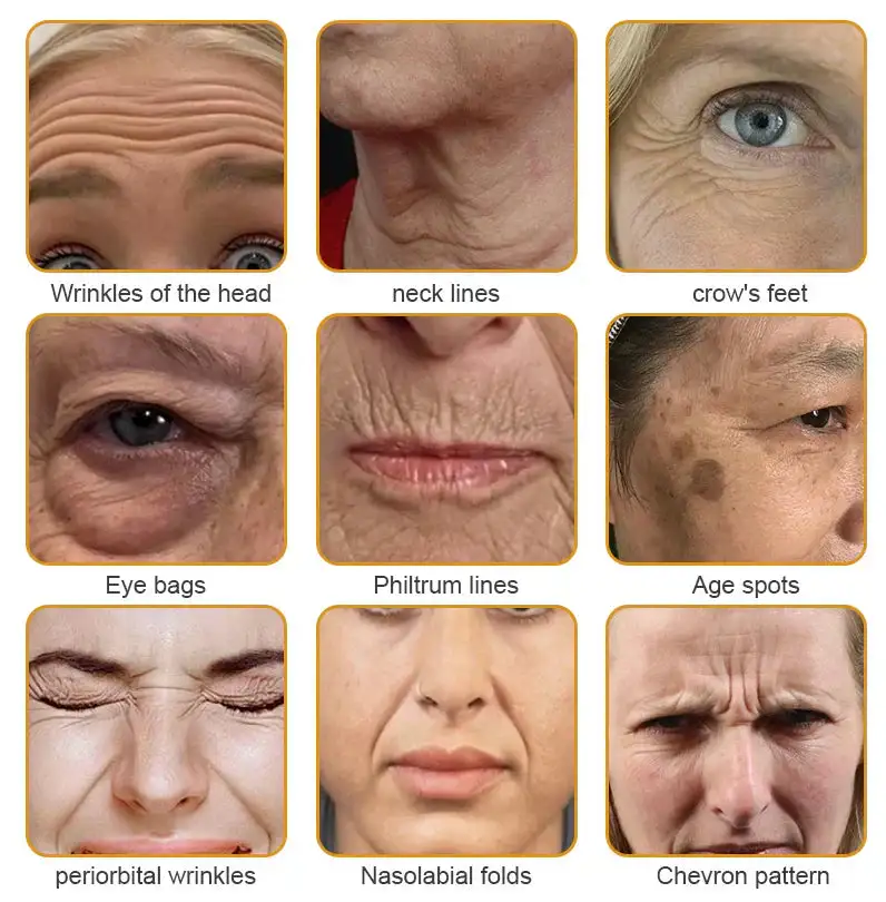 Mayo Clinic Official: coastglee®Bee Toxin Skin Treatment Cream Anti-aging, Hydrating, Skin Repair, Even Tone, Acne and Dark Spot Treatment, Wart and Mole Removal, Psoriasis Relief - Image 12