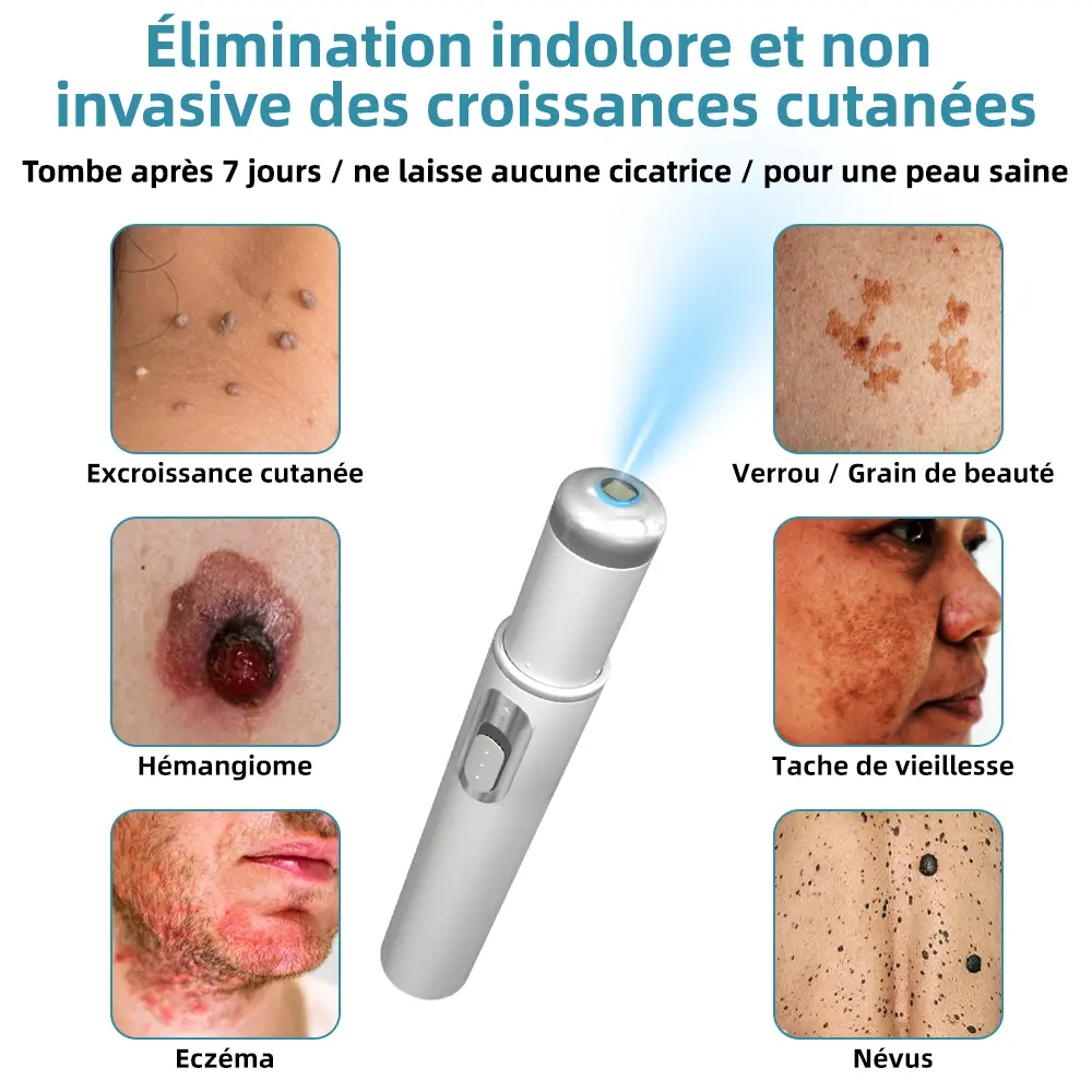 Recommandé par l’ANSM👩⚕️𝐤𝐢𝐝𝐬𝐧𝐞𝐞𝐝® 𝐆𝐫𝐚𝐢𝐧𝐬 𝐝𝐞 𝐛𝐞𝐚𝐮𝐭é 𝐞𝐭 𝐯𝐞𝐫𝐫𝐮𝐞𝐬 𝐧𝐨𝐧 𝐢𝐧𝐯𝐚𝐬𝐢𝐟𝐬 𝐒𝐭𝐲𝐥𝐨 𝐥𝐚𝐬𝐞𝐫 𝐝'é𝐥𝐢𝐦𝐢𝐧𝐚𝐭𝐢𝐨𝐧(Élimination rapide et indolore des verrues, grains de beauté, taches de vieillesse et excroissances cutanées — totalement sans effets secondaires)🎉 - Image 2