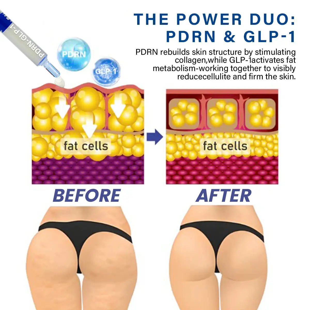 Oveallgo® PDRN-GLP-1 Slimming & Blood Sugar Regulating Reedle Shot Serum - Image 3